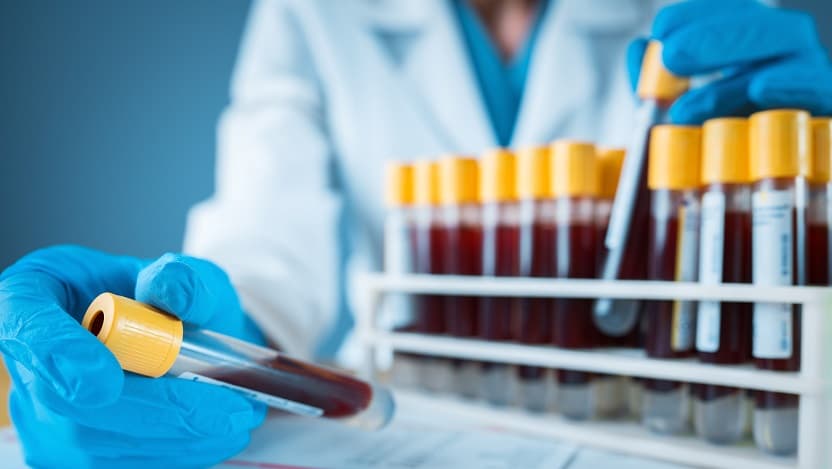 Gloved scientist's hand holding a blood-filled test tube in front of a rack of more blood-filled test tubes.