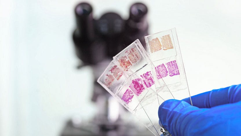Histological tissue sample on slide with microscope in back