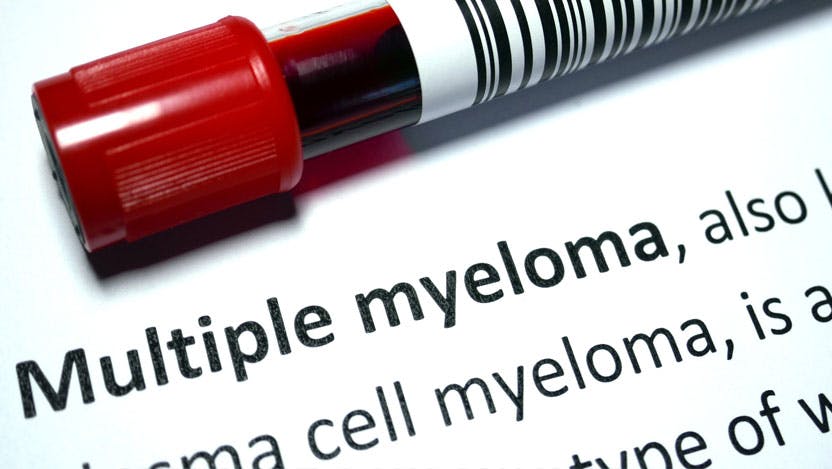 multiple myeloma 