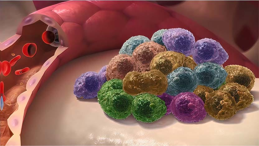 A 3D illustration of multiple myeloma, a type of cancer.