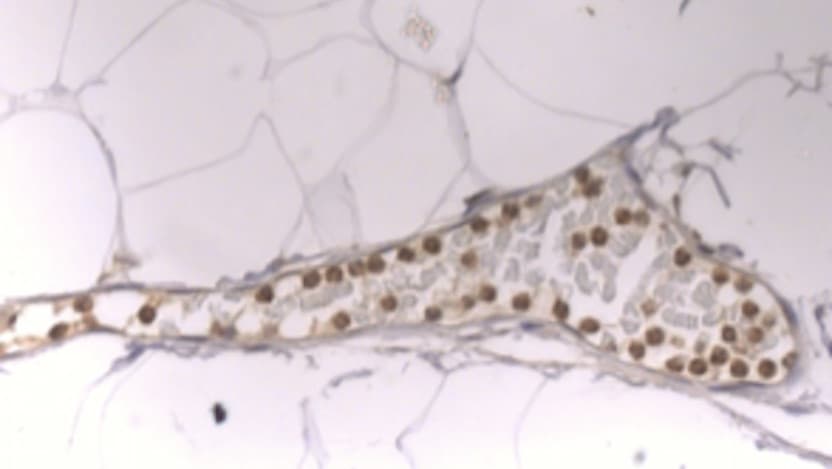 neutrophils