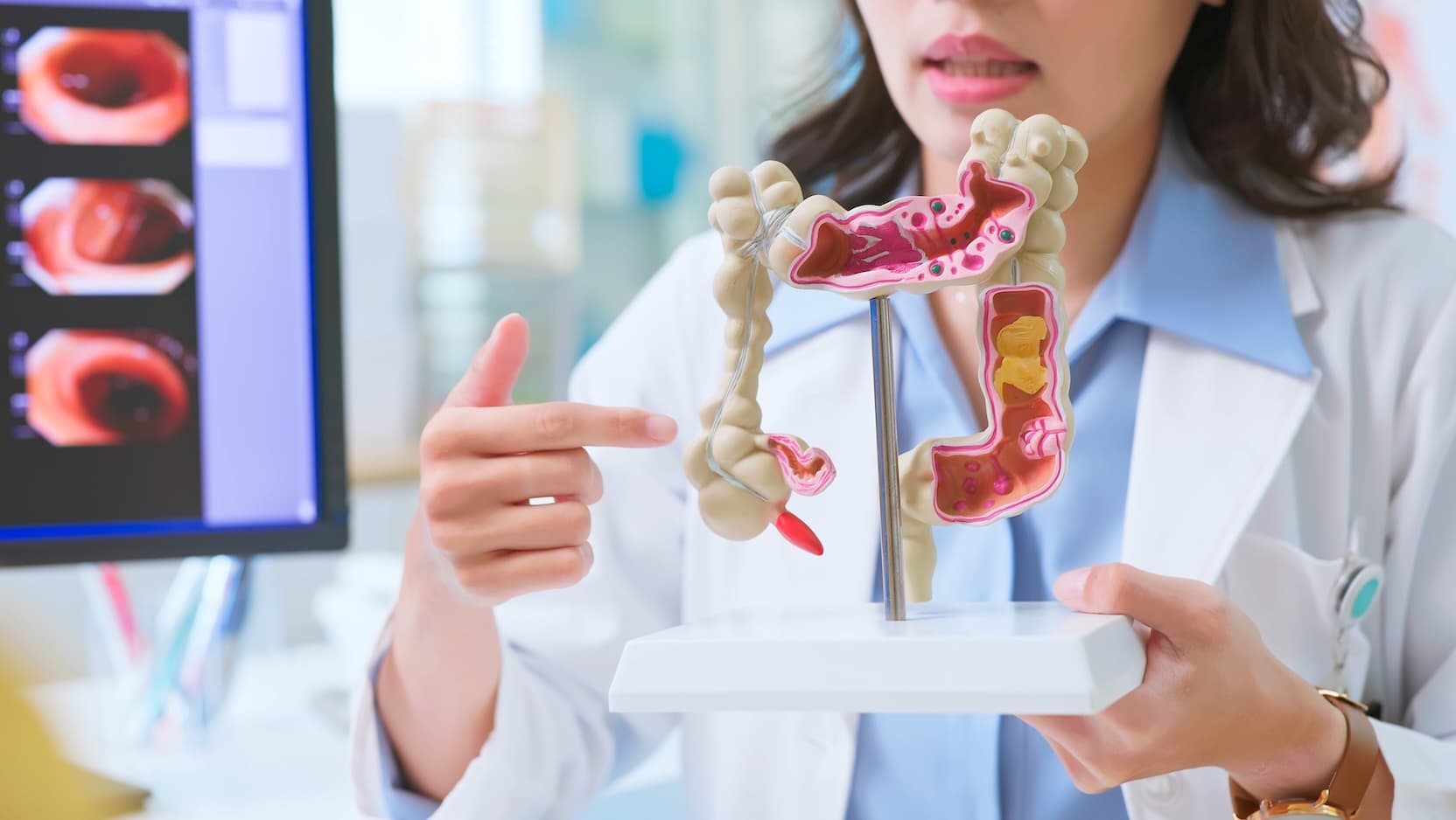Physician displaying model of colon
