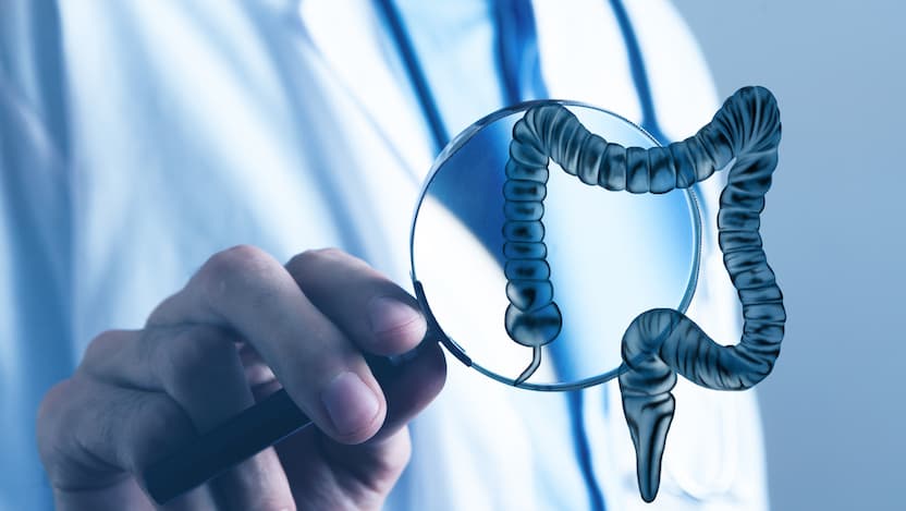 Physician holding up magnifying glass with illustration of colon emerging from the glass