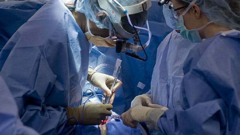 Cardiac surgery team performing heart transplant