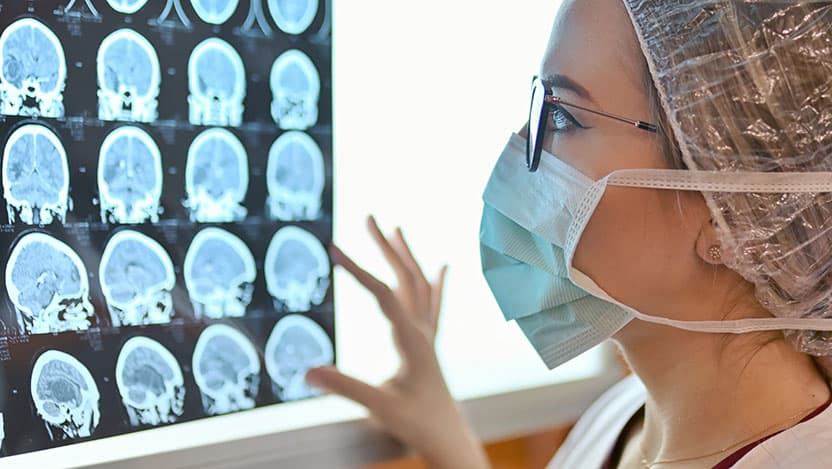 brain cancer
