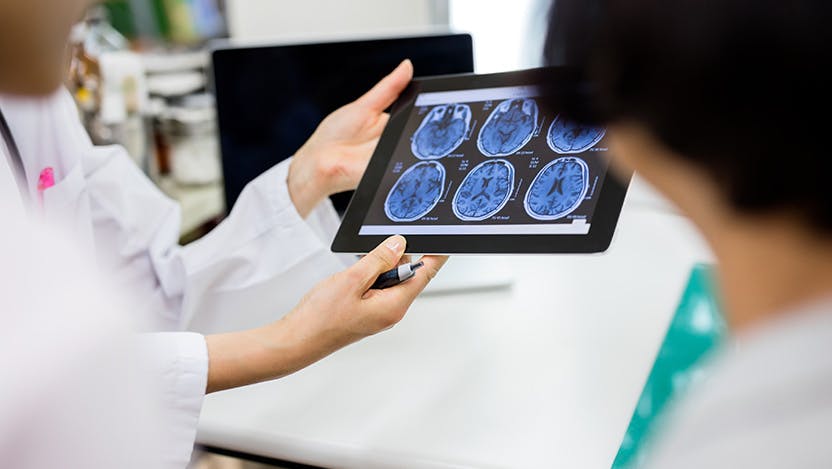 A physician reviews a tablet with images of a brain scan.