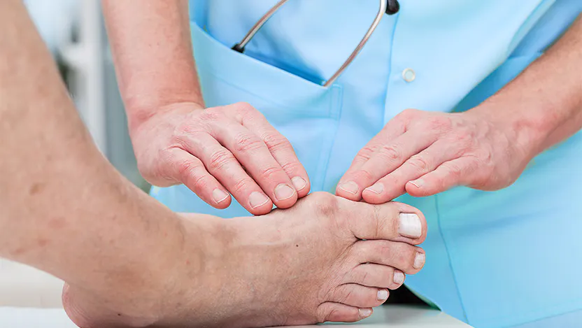 doctor reviews a bunion