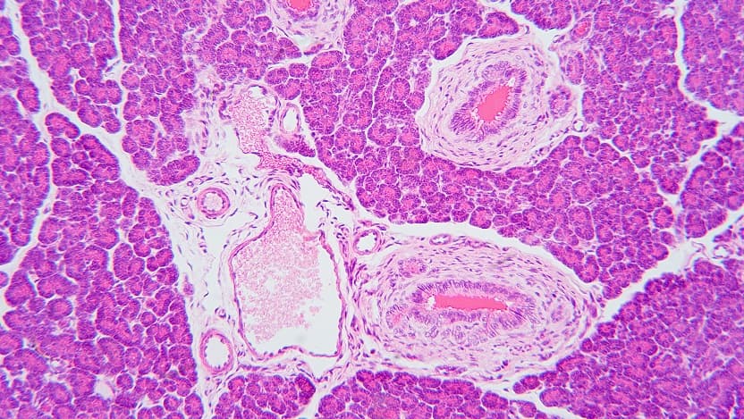 microscopic image of pancreatic cells dyed pink for visibility