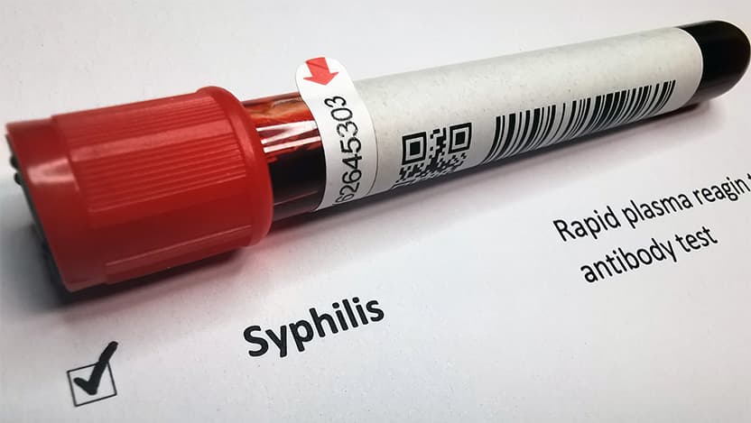 Syphilis blood test