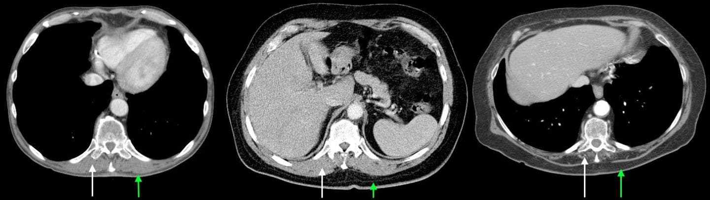 chest scans