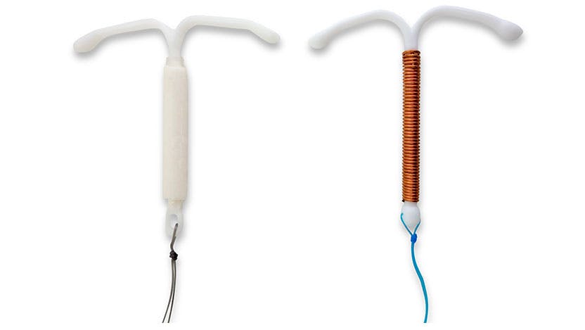 Two typed of IUDS, hormonal and copper