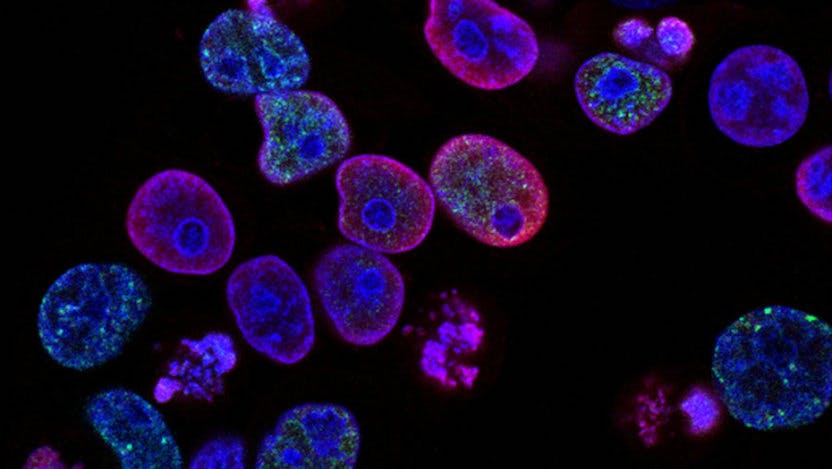 Ovarian cancer cells (Image: National Cancer Institute)