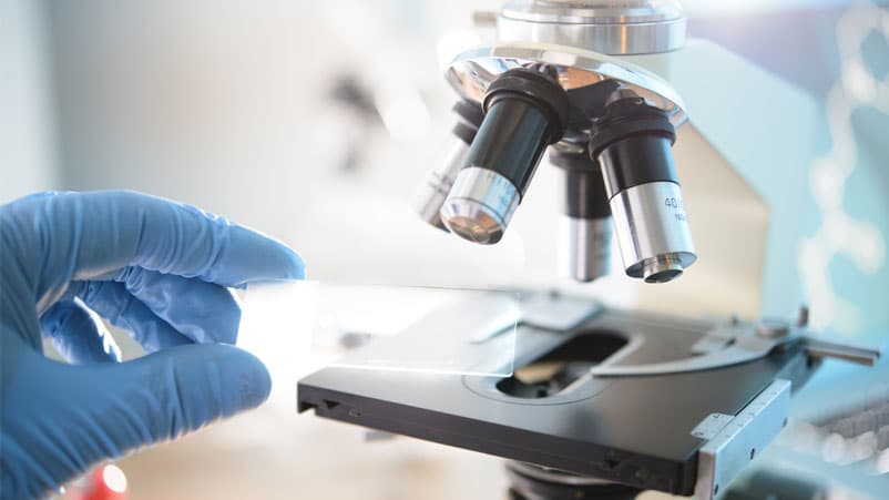 hand putting slide on microscope