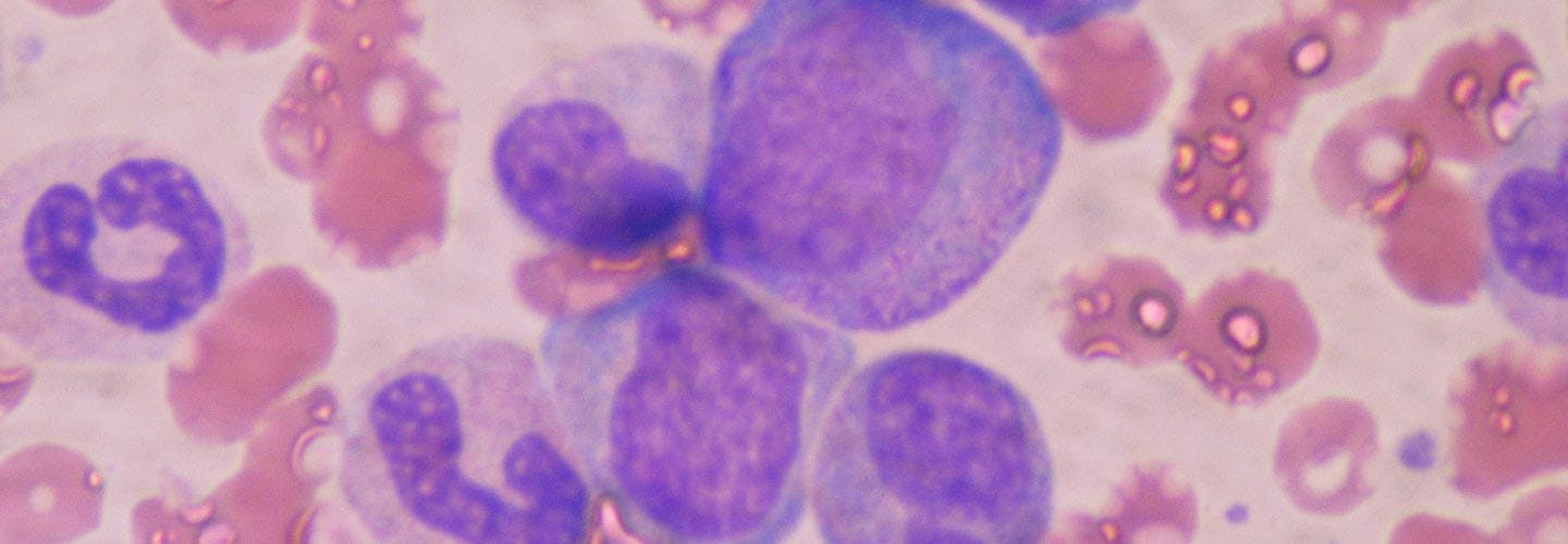 Hematopoietic stem cells in bone marrow